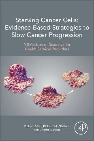 Cover of Starving Cancer Cells: Evidence-Based Strategies to Slow Cancer Progression