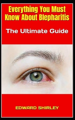 Book cover for Everything You Must Know About Blepharitis