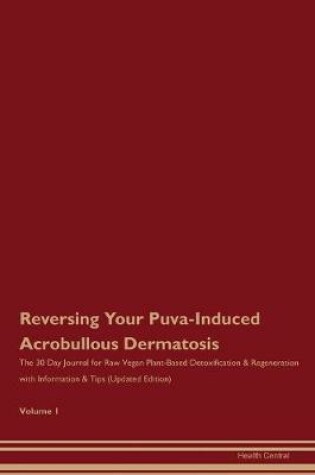 Cover of Reversing Your Puva-Induced Acrobullous Dermatosis