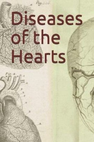 Cover of Diseases of the Hearts