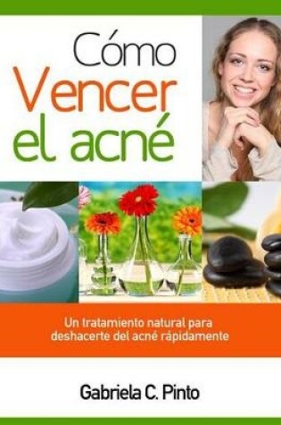 Cover of Como Vencer El Acne