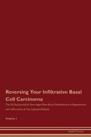 Cover of Reversing Your Infiltrative Basal Cell Carcinoma