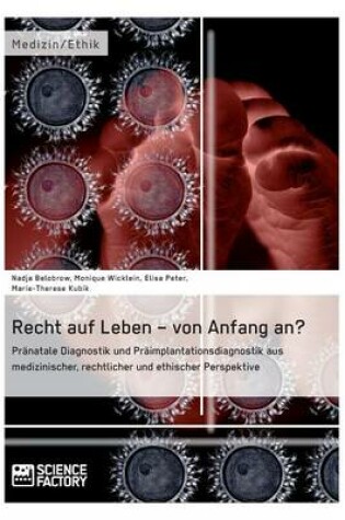 Cover of Recht auf Leben - von Anfang an?
