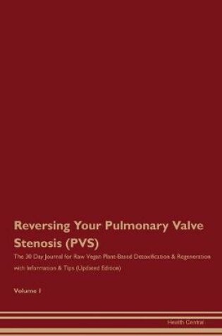 Cover of Reversing Your Pulmonary Valve Stenosis (PVS)