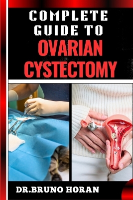 Book cover for Complete Guide to Ovarian Cystectomy