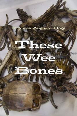 Book cover for These Wee Bones