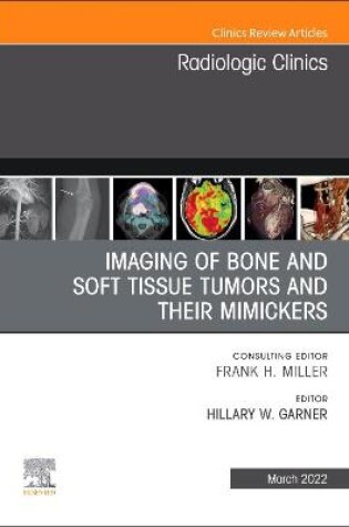 Cover of Imaging of Bone and Soft Tissue Tumors and Mimickers, an Issue of Radiologic Clinics of North America
