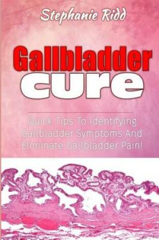 Cover of Gallbladder Cure