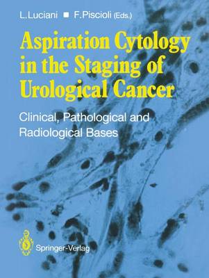 Book cover for Aspiration Cytology in the Staging of Urological Cancer