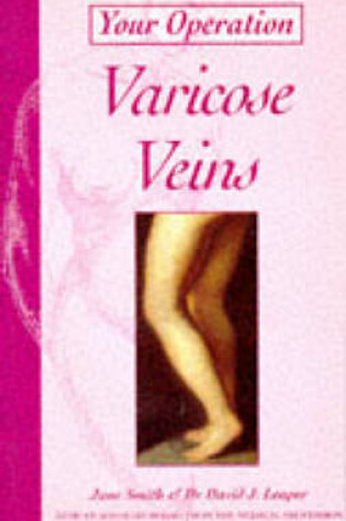 Cover of Varicose Veins