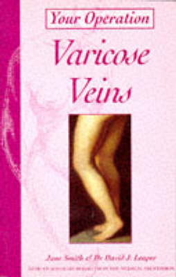 Cover of Varicose Veins