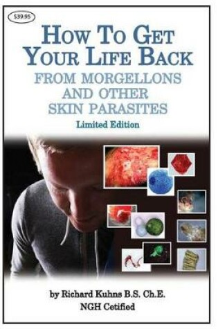 Cover of How to Get Your Life Back From Morgellons and Other Skin Parasites Limited Edit