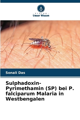 Book cover for Sulphadoxin-Pyrimethamin (SP) bei P. falciparum Malaria in Westbengalen