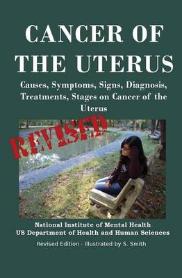 Book cover for Cancer of the Uterus