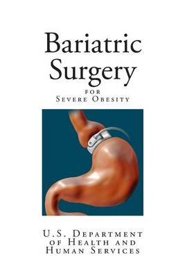 Book cover for Bariatric Surgery