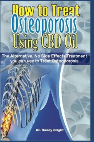 Cover of How to Treat Osteoporosis Using CBD Oil