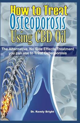 Cover of How to Treat Osteoporosis Using CBD Oil