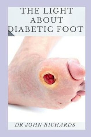 Cover of The Light About Diabetic Foot