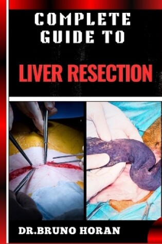 Cover of Complete Guide to Liver Resection