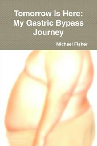 Cover of Tomorrow is Here: My Gastric Bypass Journey