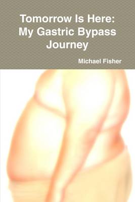 Book cover for Tomorrow is Here: My Gastric Bypass Journey