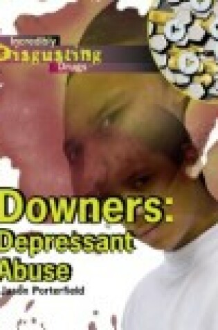 Cover of Downers