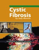 Book cover for Cystic Fibrosis (Perspec. Dise