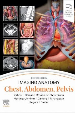 Cover of Chest, Abdomen, Pelvis - E-Book
