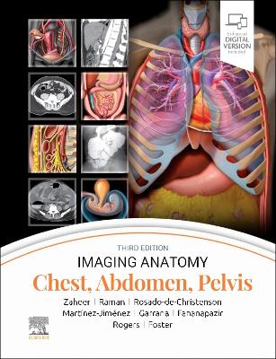 Book cover for Chest, Abdomen, Pelvis - E-Book