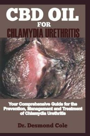Cover of CBD Oil for Chlamydia Urethritis