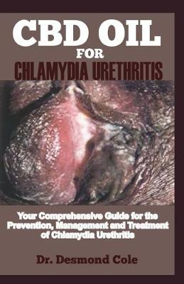 Book cover for CBD Oil for Chlamydia Urethritis