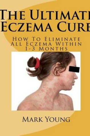 Cover of The Ultimate Eczema Cure