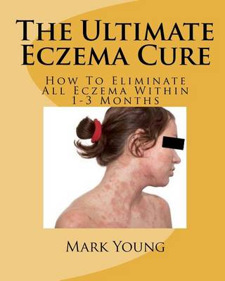 Book cover for The Ultimate Eczema Cure