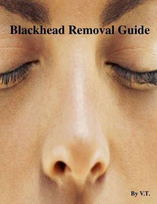 Book cover for Blackhead Removal Guide