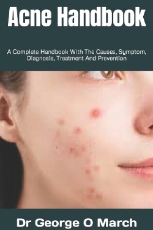 Cover of Acne Handbook