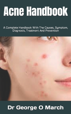 Book cover for Acne Handbook