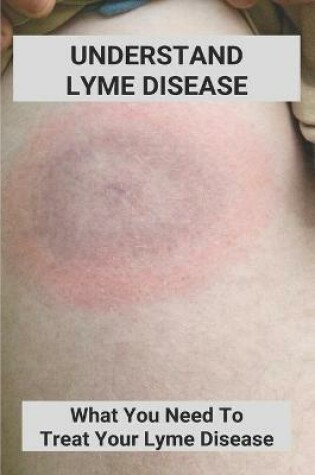 Cover of Understand Lyme Disease