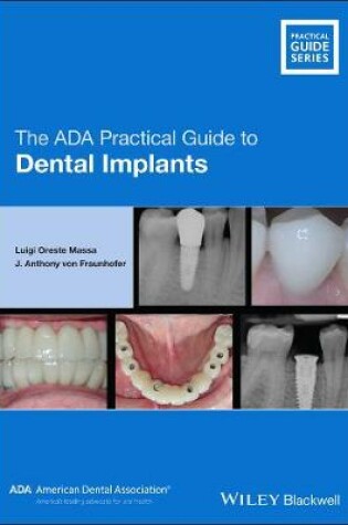 Cover of The ADA Practical Guide to Dental Implants