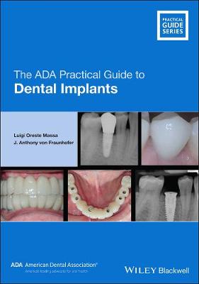 Book cover for The ADA Practical Guide to Dental Implants