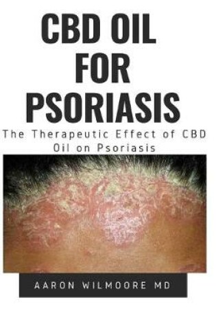 Cover of CBD Oil for Psoriasis