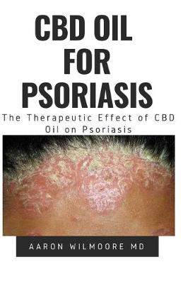 Book cover for CBD Oil for Psoriasis