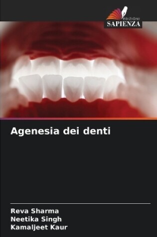 Cover of Agenesia dei denti