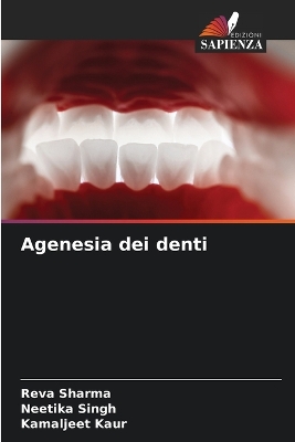 Cover of Agenesia dei denti