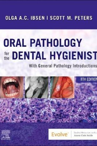 Cover of Oral Pathology for the Dental Hygienist E-Book