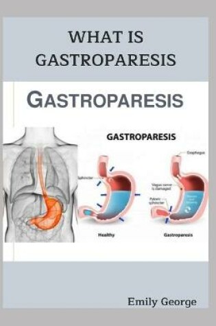 Cover of What Is Gastroparesis