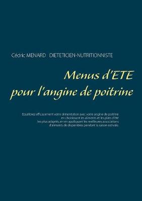 Book cover for Menus d'été pour l'angine de poitrine