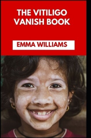 Cover of The Vitiligo Vanish Book
