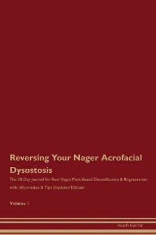 Cover of Reversing Your Nager Acrofacial Dysostosis