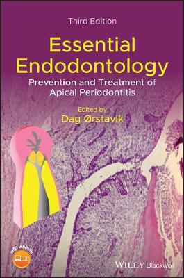 Book cover for Essential Endodontology