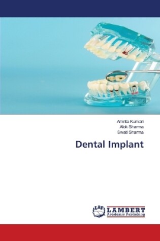 Cover of Dental Implant